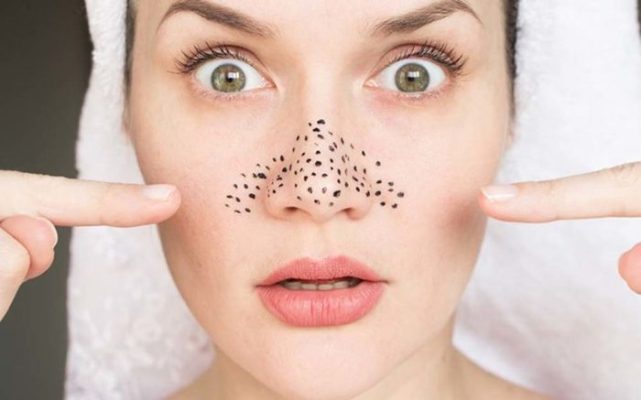 Hướng dẫn các cách cách trị mụn đầu đen ở mũi tại nhà