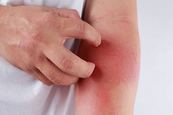Nhận biết sớm dấu hiệu hiv ở nam giới trước khi quá muộn