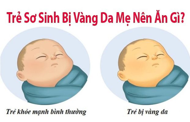 [Bật Mí] Trẻ sơ sinh bị vàng da mẹ nên ăn gì tốt?