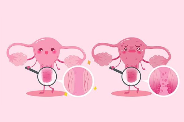 Những triệu chứng sùi mào gà ở nữ giới giai đoạn đầu