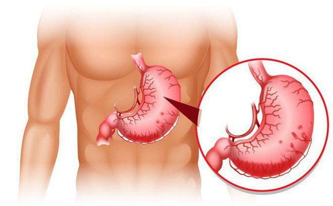 Dạ dày nằm ở đâu? Cấu tạo như thế nào và chức năng ra sao?