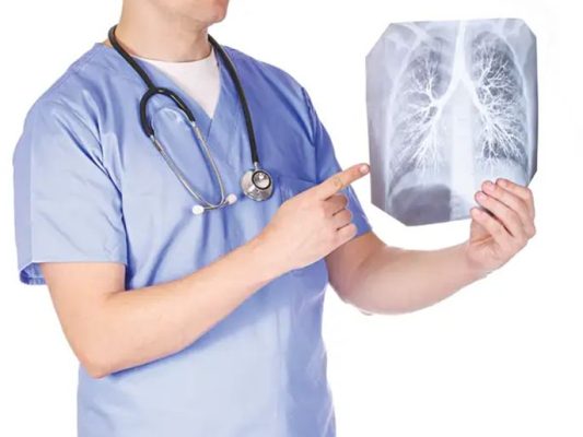 Tìm hiểu phế quản nằm ở đâu? Cấu tạo của phế quản