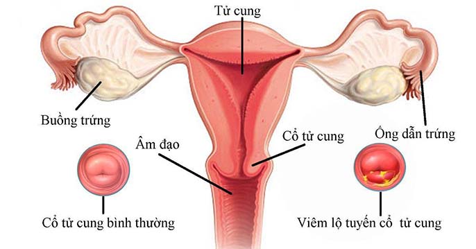 Những điều bạn chưa biết về tử cung nằm ở đâu?
