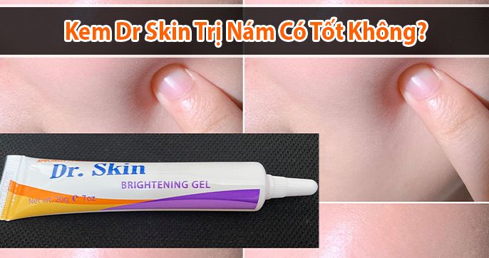 Giải đáp thắc mắc: Sử dụng kem dr skin trị nám có tốt không?