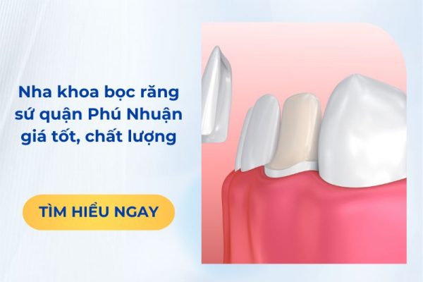 Nha khoa bọc răng sứ quận Phú Nhuận giá tốt, chất lượng