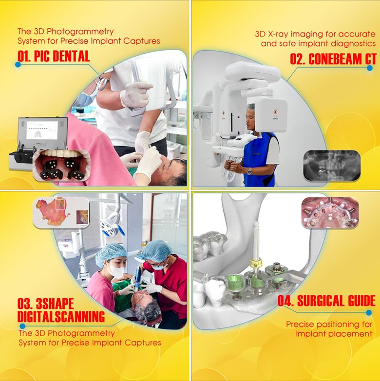 Top 1 Dental Implant Holiday Vietnam: A Comprehensive Guide To Restoring Your Smile In Saigon