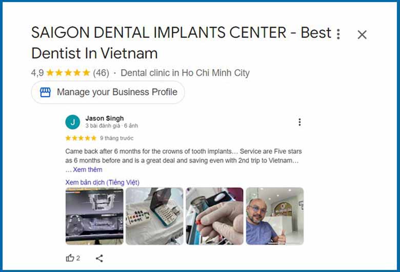 Dental Implant Bridges - A Comprehensive Guide from Saigon Implant Center